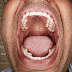 Guinness World Record most teeth